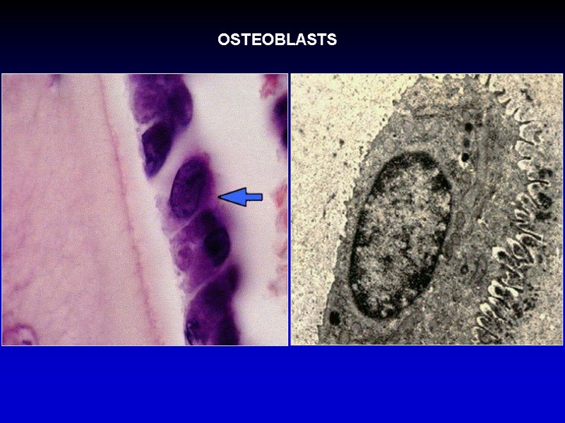 OSTEOBLASTS